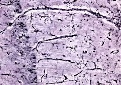Microglia stained black
